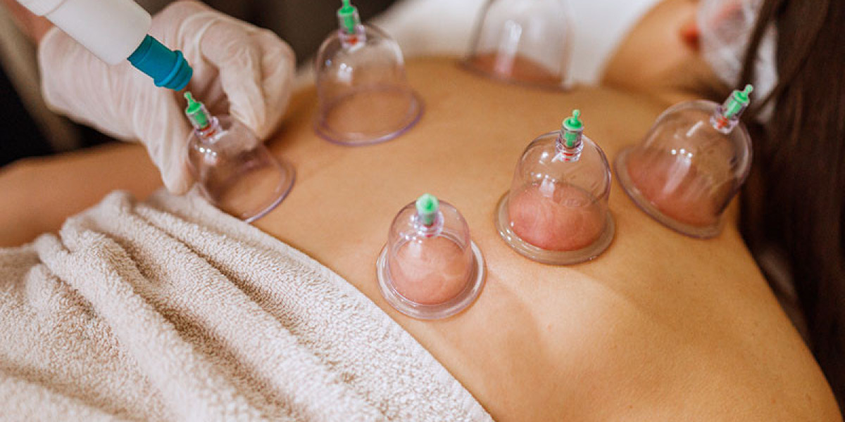 Your Guide to Finding Safe and Effective Cupping Therapy in Mumbai
