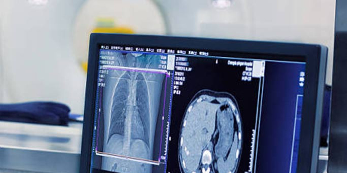 Enhance Diagnostic Accuracy with a Brand new X-ray machine