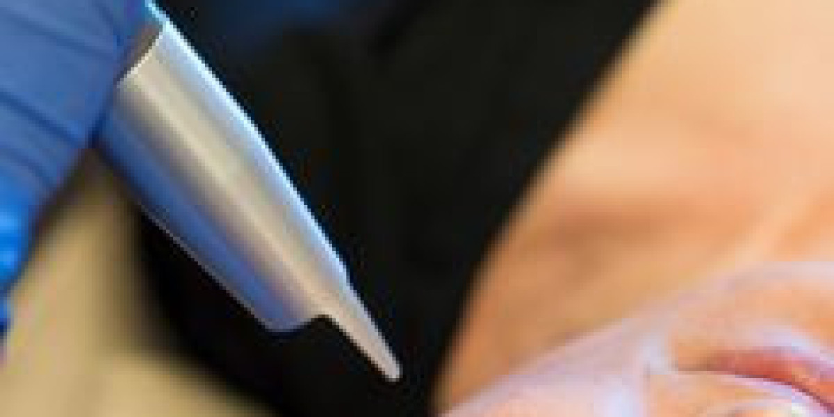 Why Vancouver Cold Laser Therapy Is Becoming a Go-To Solution for Pain Relief