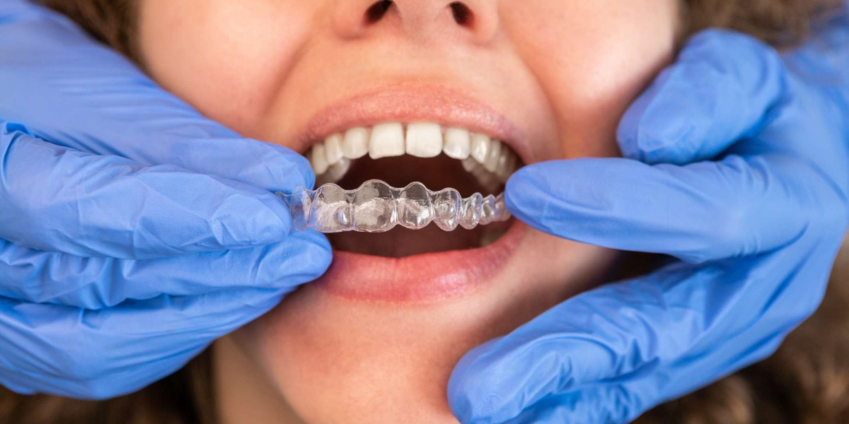 Bridging the Gap: Dental Implants vs. Conventional Bridges