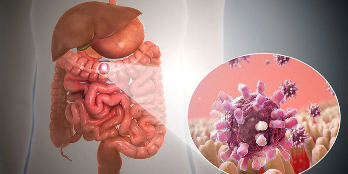 Gastroenteritis: What It Is, Symptoms, Causes & Treatment