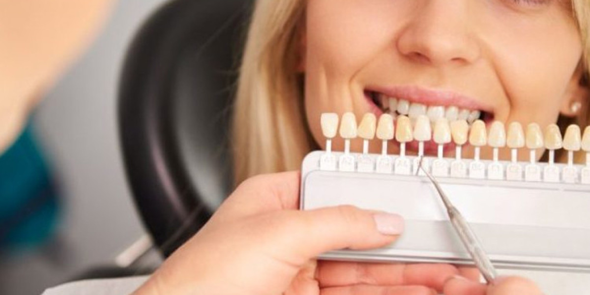 Dentures Sydney | Natural-Looking & Comfortable Fit