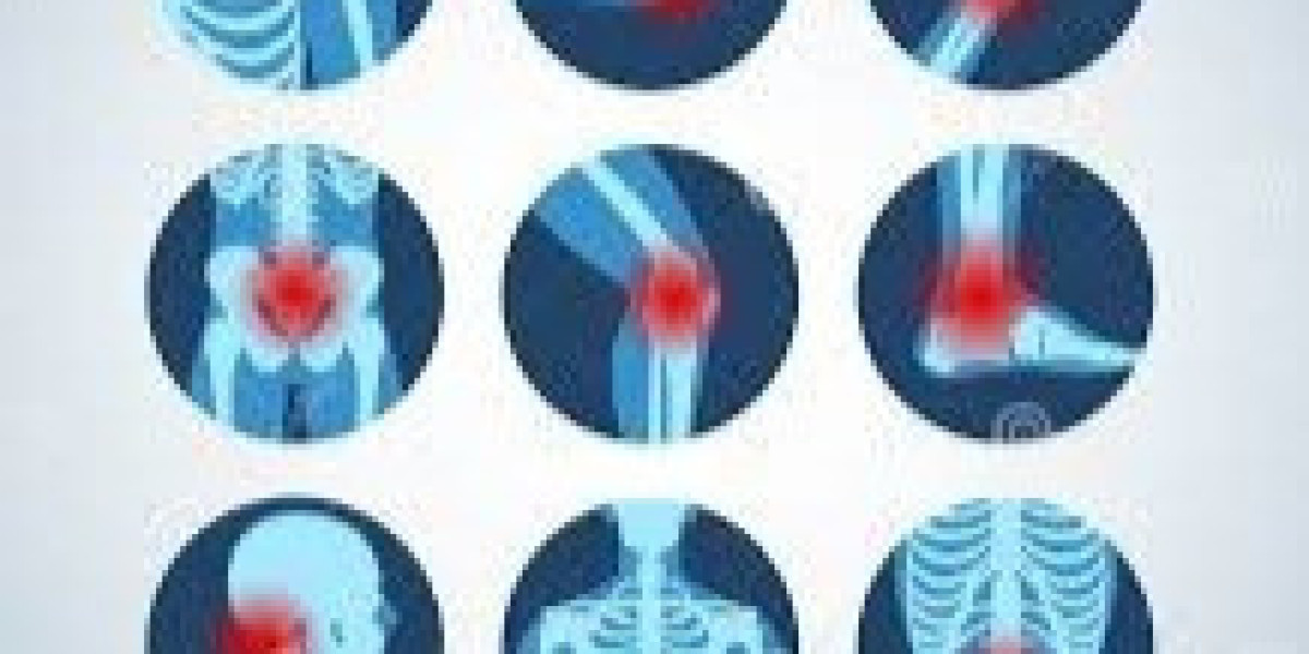 Lyrica 75 mg: How Pregabalin Supports Nerve and Mental Health