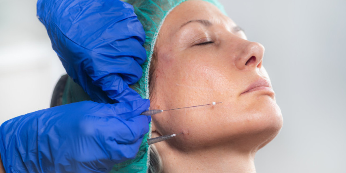 Aesthetic Threads Market Growth & Industry Forecast 2034