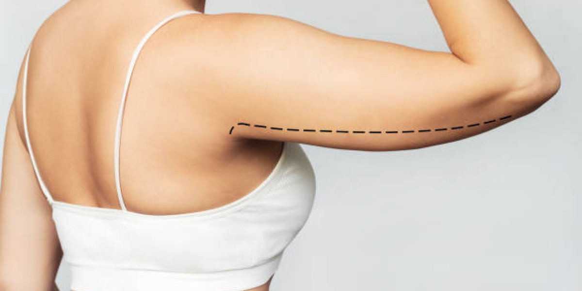 Fast Liposuction Surgery in Dubai Results
