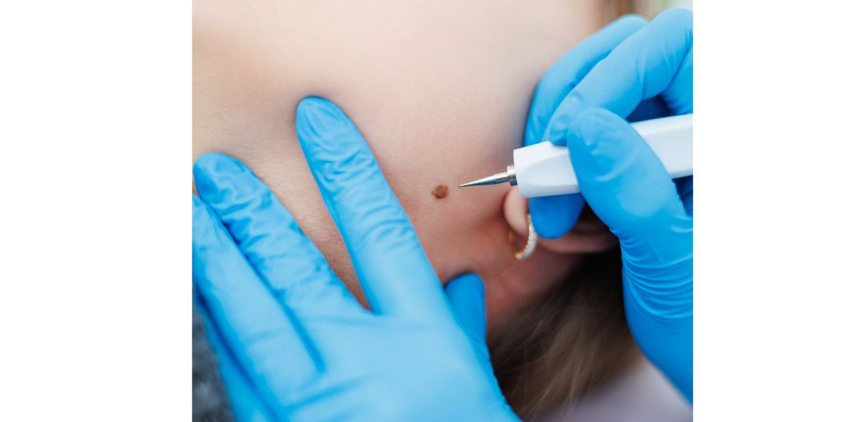 Sun Damage and Pigmentation: The Most Effective Treatments That Actually Work