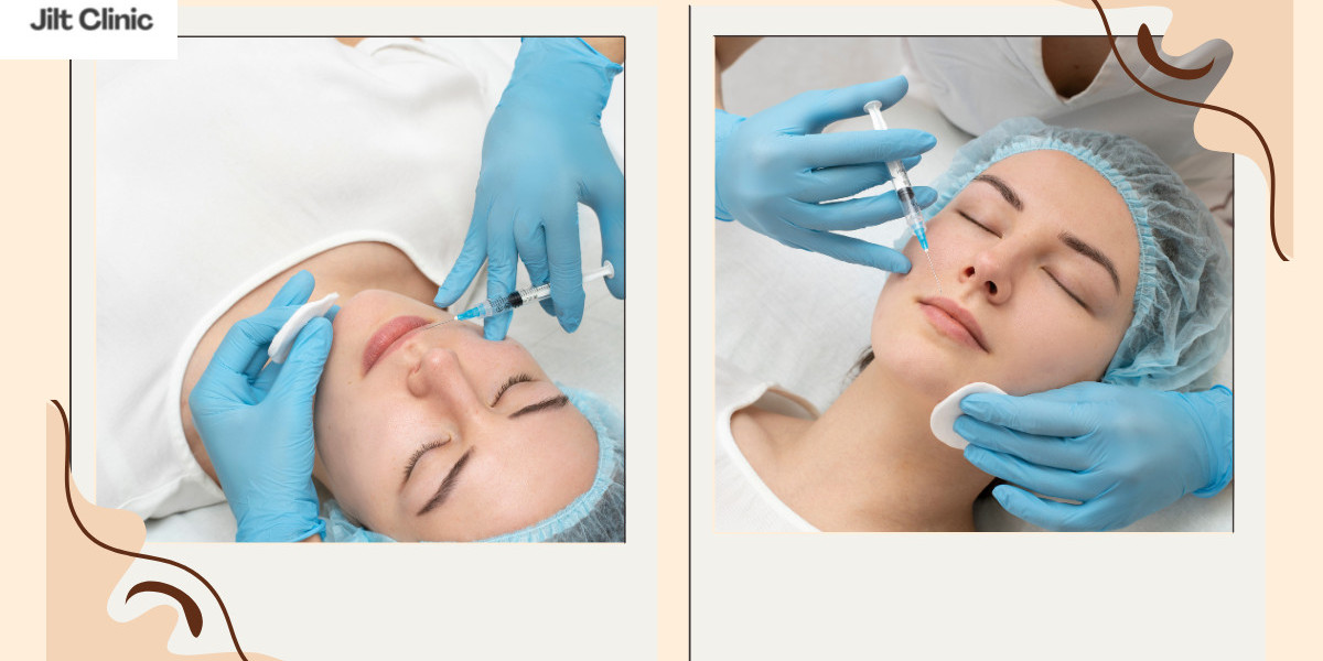 Fett weg Spritze Zürich – Sanfte Körperformung für moderne Ansprüche