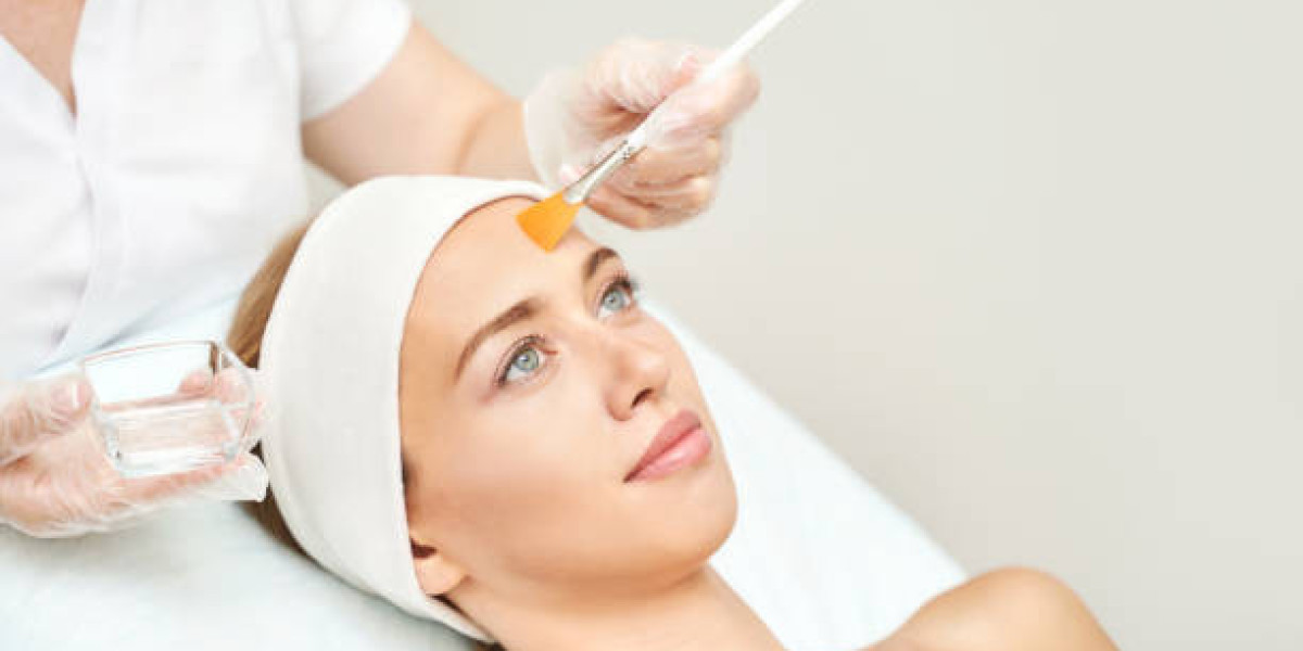 Preparing for Chemical Peels: Essential Skin Care Steps