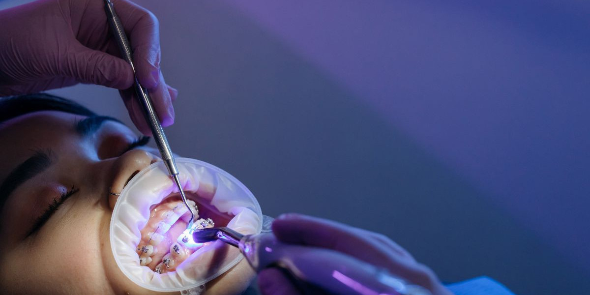 Do You Really Need a Root Canal? Signs You Shouldn’t Ignore