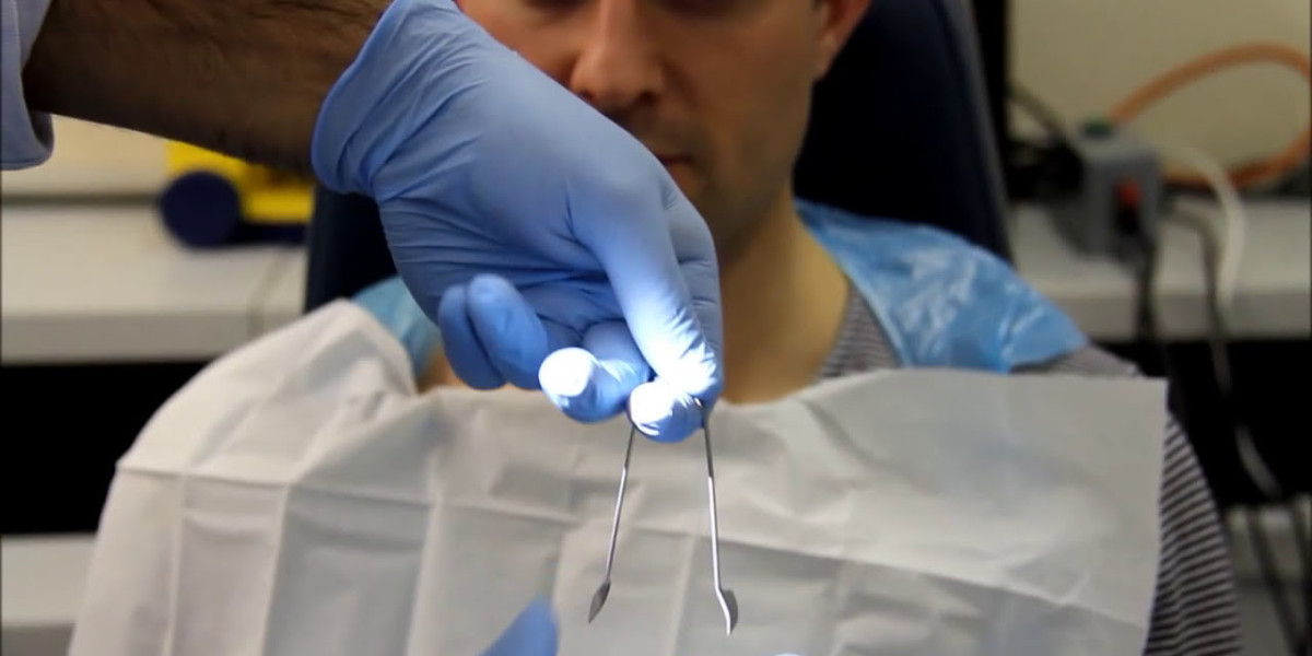 Foreign Body Removal with Advanced Medical Techniques