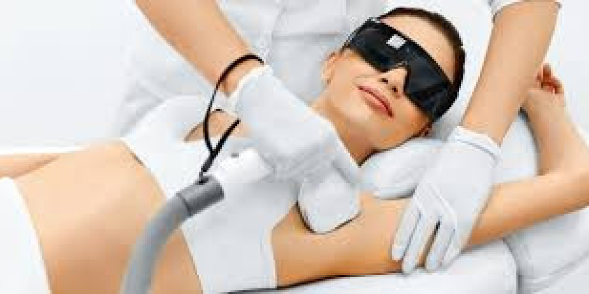 Laser Hair Removal Ottawa: Expert Guide to Safe, Effective Treatments