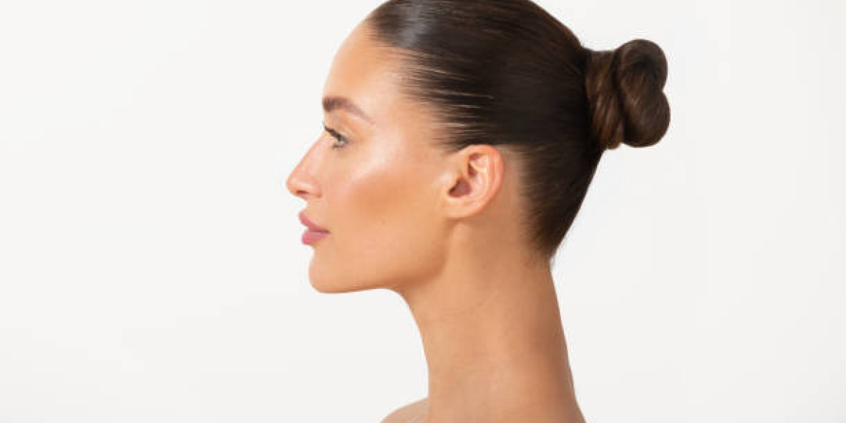 Revision Rhinoplasty: Fixing Unsatisfactory Results